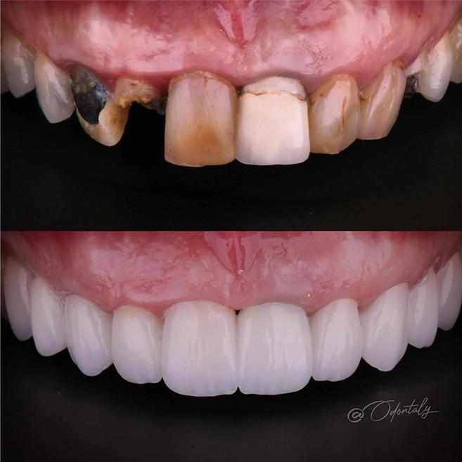 odontaly__2025-06-23T211842.000Z copiar