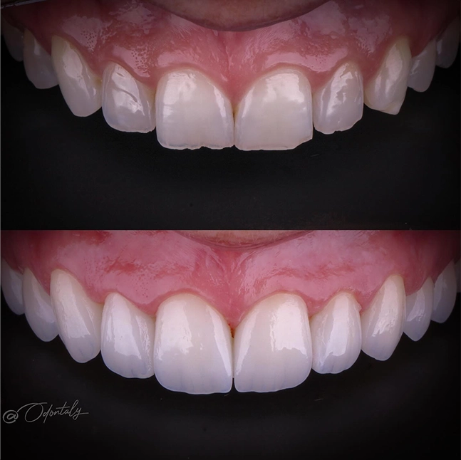 odontaly__2025-07-26T200234.000Z copiar