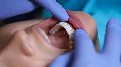 Reabilitação Oral Odontaly